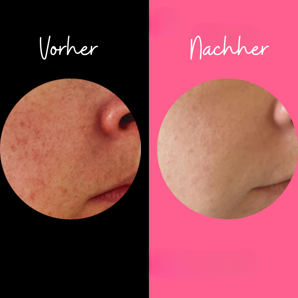Éponge Exfoliante Douce pour le Corps – Lot de 2, Tous Types de Peau