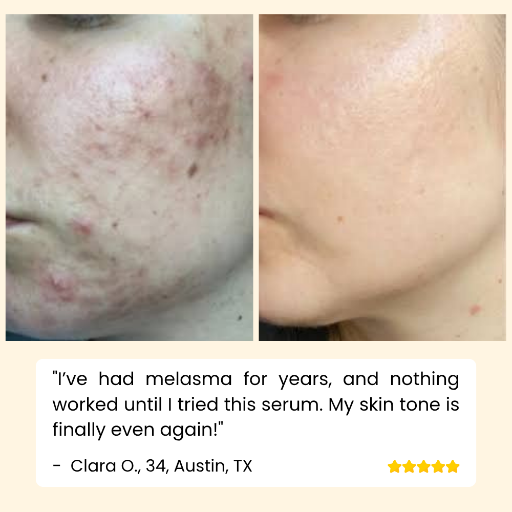 Sérum Vitamine C Visage, Mains et Corps pour une Peau Éclatante
