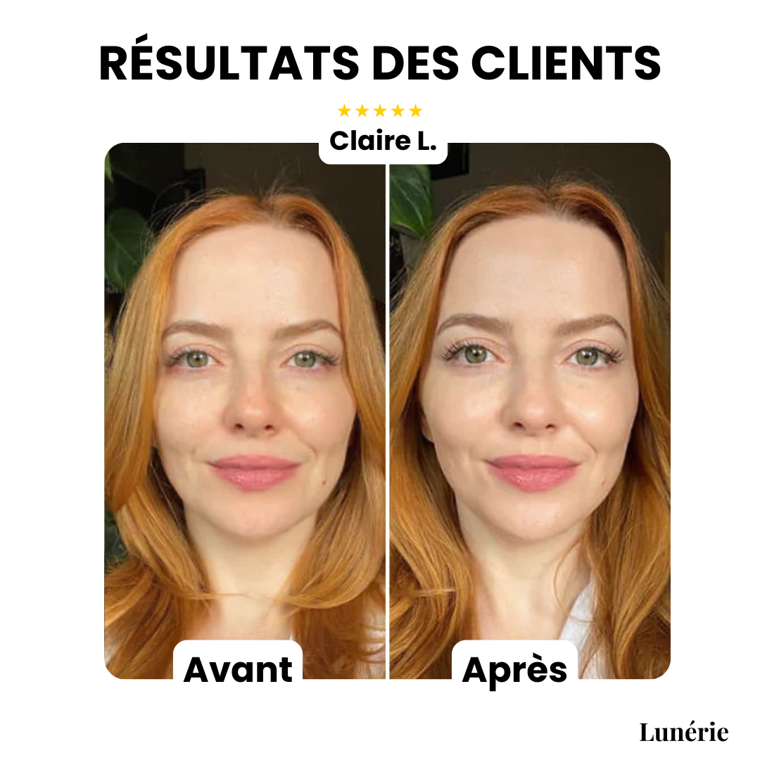 DewCream™ – Soin Éclaircissant à la Couvrance Lumineuse [50 % de Réduction]