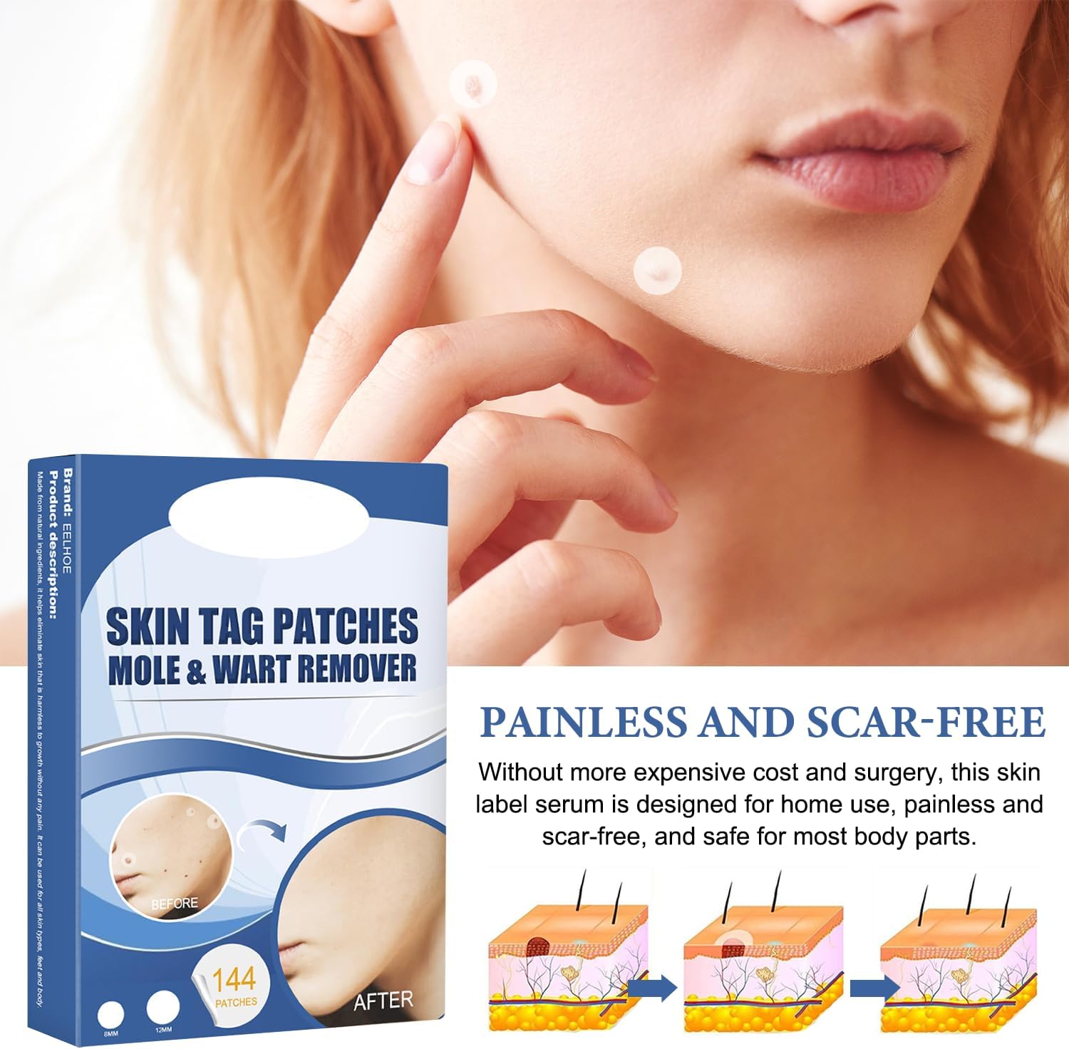 PatchAway™ – Éliminez les lambeaux de peau sans douleur et sans effort [50 % de réduction]