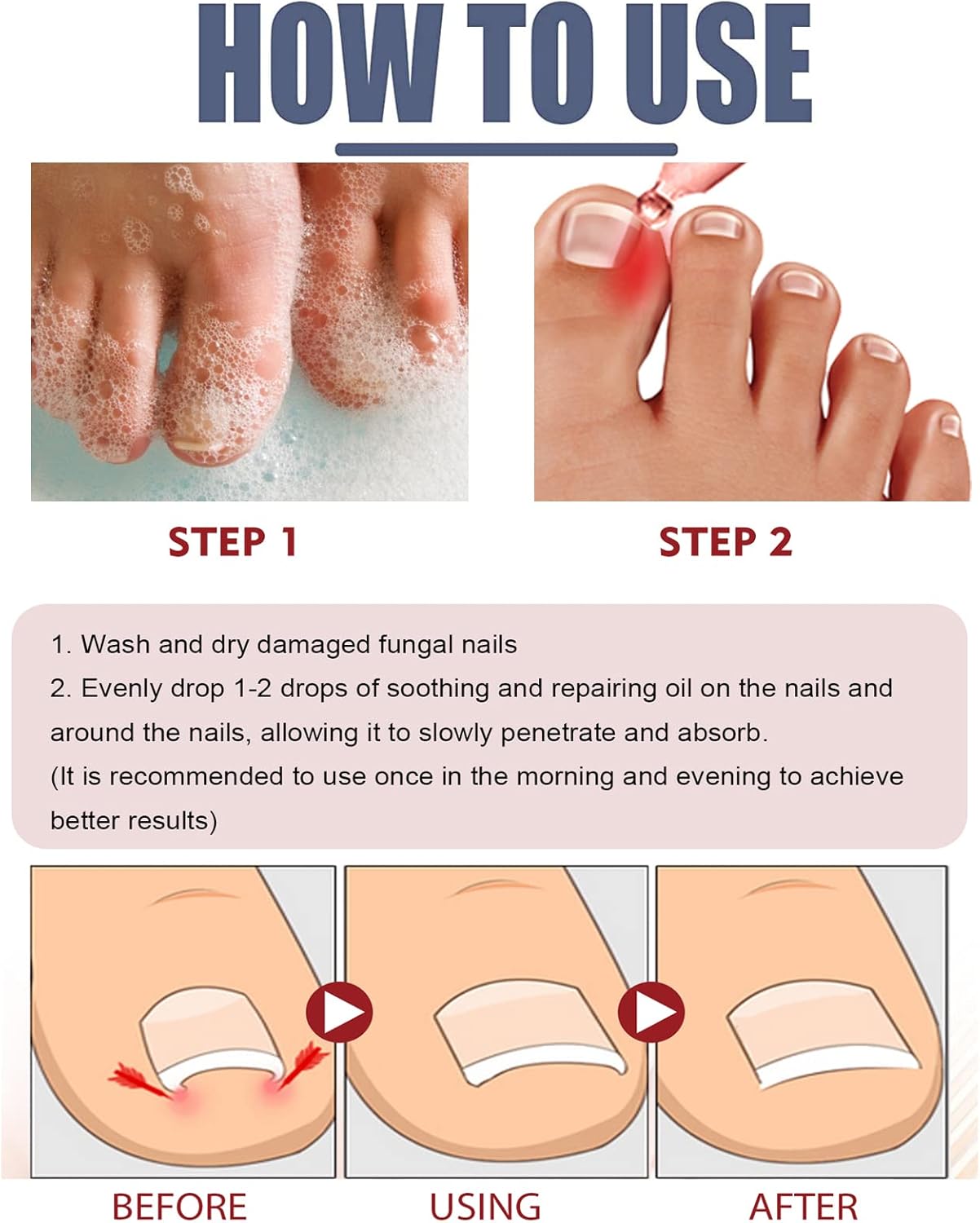 Sérum Intensif Nourrissant pour Ongles des Pieds et des Mains