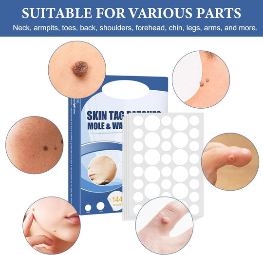 SkinPatch™ – Traitement indolore et non invasif pour une peau visiblement claire et saine [1 + 1 Gratuit]