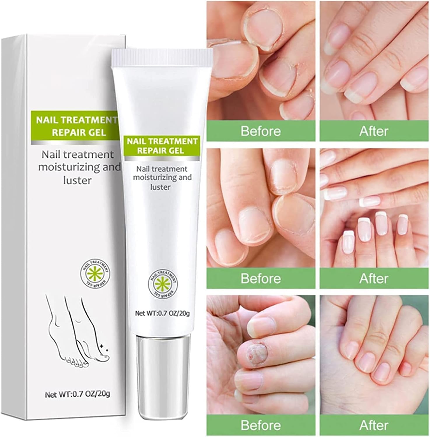RejuveNail™ – Renforce Durablement des Ongles Sains & Élégants [1 + 1 Gratuit]