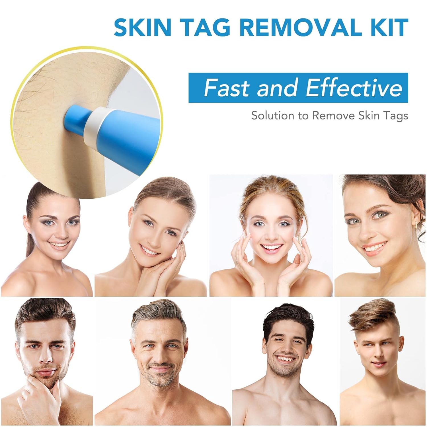 DermaFix™ – Kit avancé pour l’élimination des verrues [1 + 1 Gratuit]