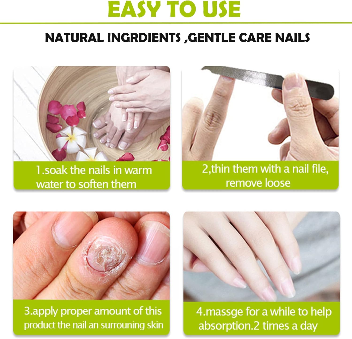 RejuveNail™ – Renforce Durablement des Ongles Sains & Élégants [1 + 1 Gratuit]