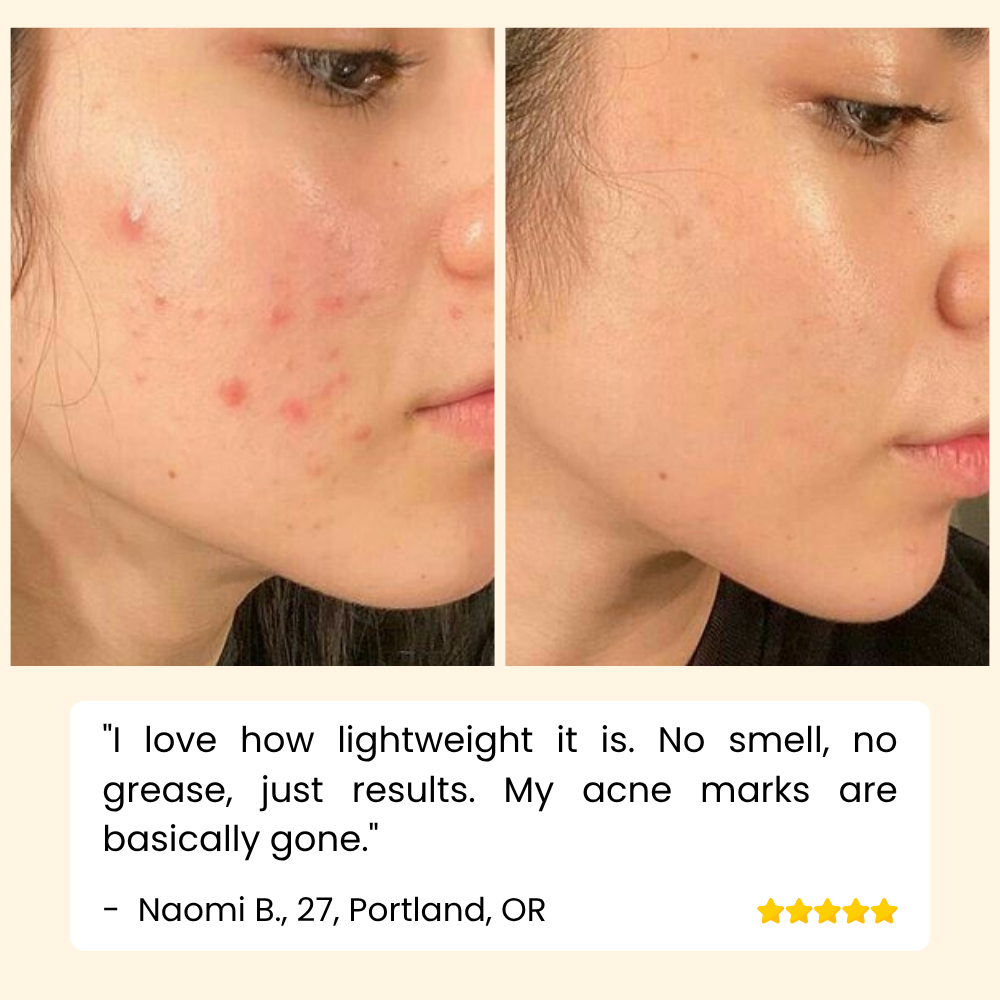Sérum Vitamine C Visage, Mains et Corps pour une Peau Éclatante