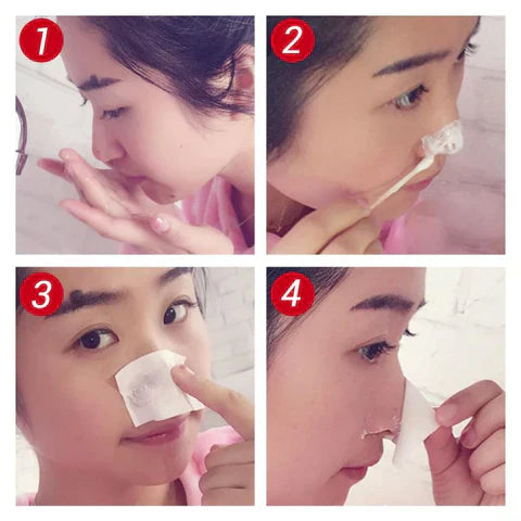 SkinGlow™ – La solution naturelle contre les points noirs, les pores obstrués et le teint terne [1 + 1 Gratuit]