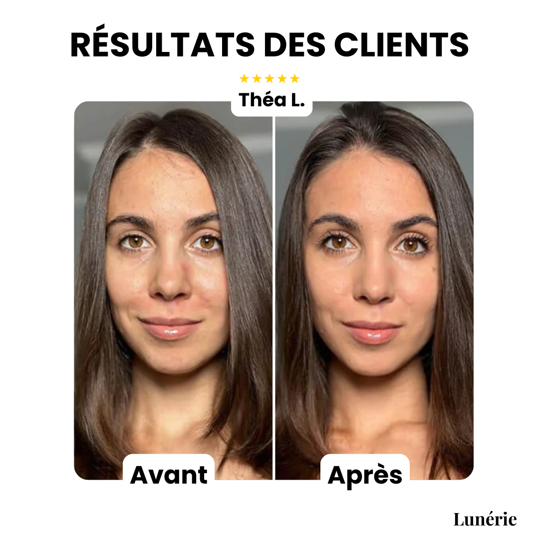 DewCream™ – Soin Éclaircissant à la Couvrance Lumineuse [50 % de Réduction]