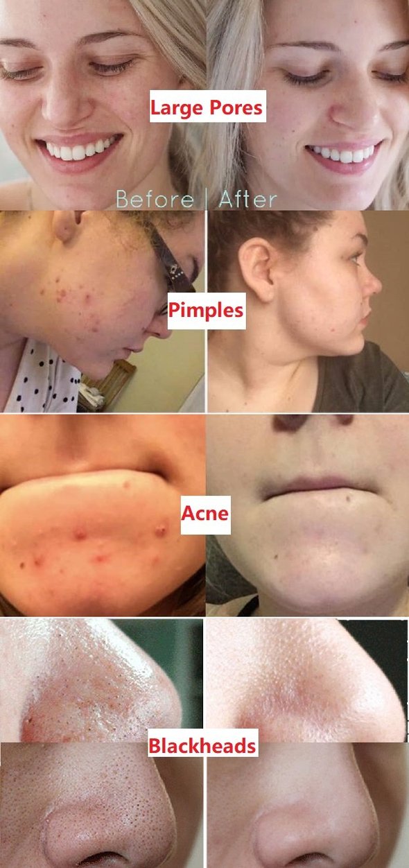 Masque Nettoyant Visage au Thé Vert en Stick pour Pores Purifiés