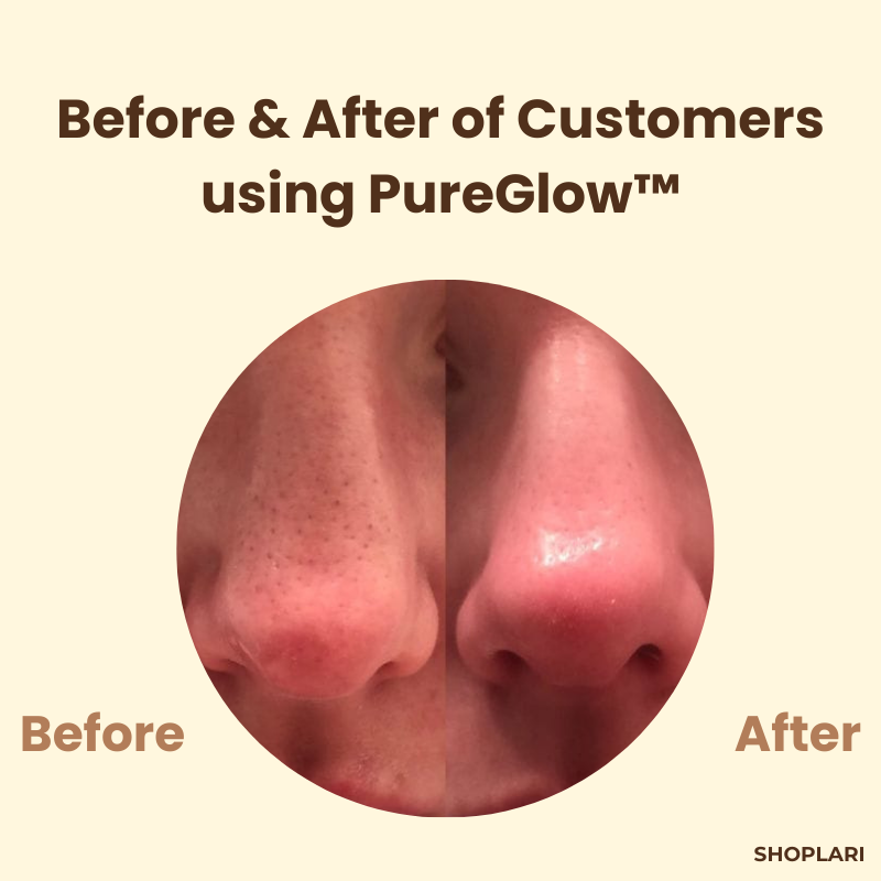 PureGlow™ – Peau claire et jeune qui inspire confiance [1 + 1 Gratuit]