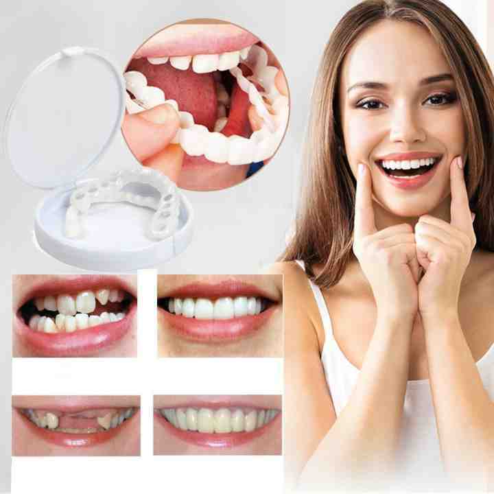 Prothèse Dentaire Snap-On Flexible pour un Sourire Naturel
