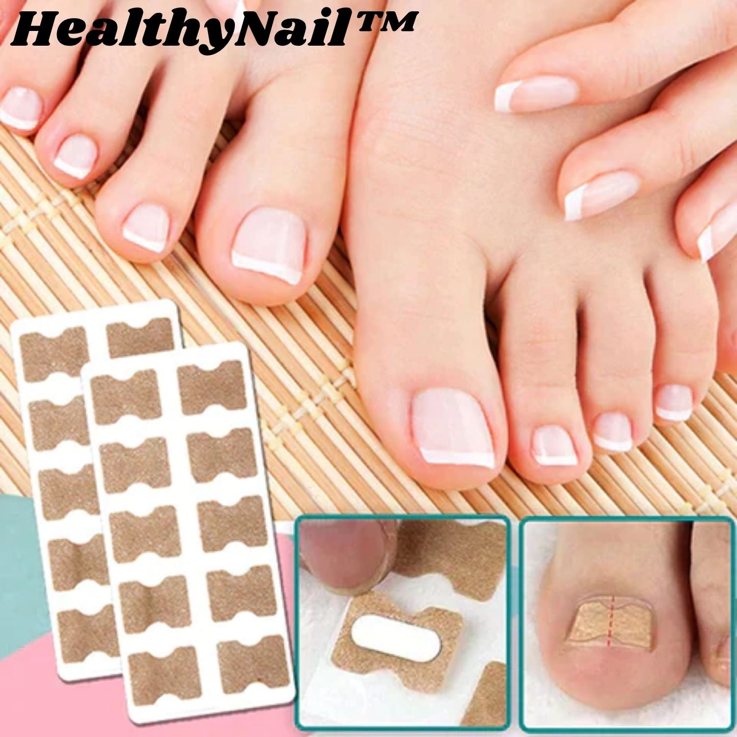 Correcteur d'Ongles Incarnés – Patchs de Redressement pour Pieds Soignés