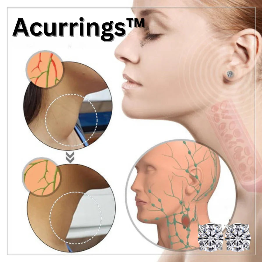 Acurrings™ – Boucles d'oreilles magnétiques thérapeutiques (Dernier jour de réduction) [1 + 1 Paire]