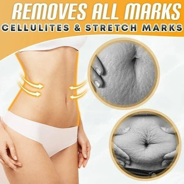 BellyDrain™ – Huiles naturelles pour une réduction sûre de la cellulite [1 + 1 Gratuit]