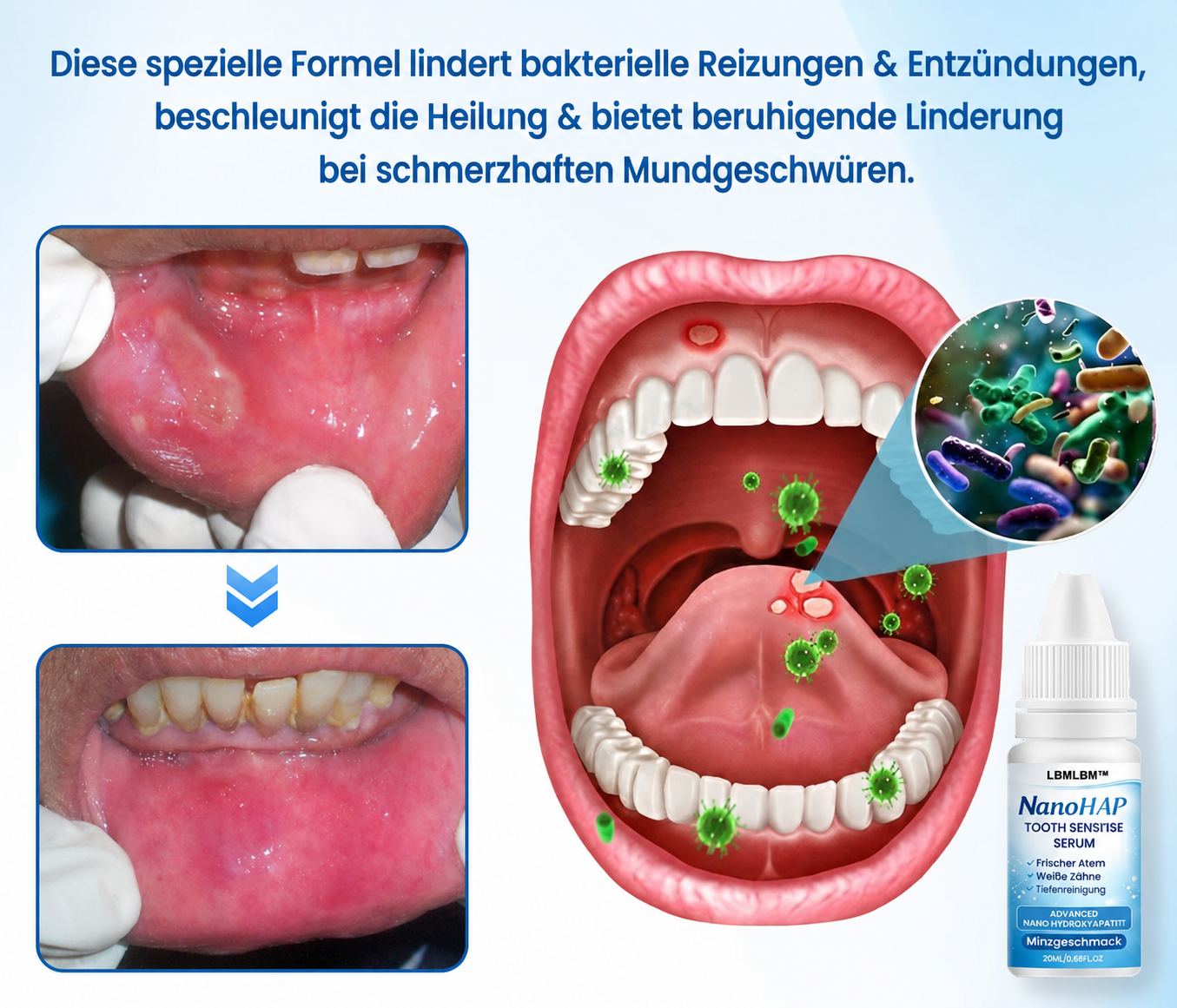 Sérum dentaire à la nano-hydroxyapatite pour émail et sensibilité