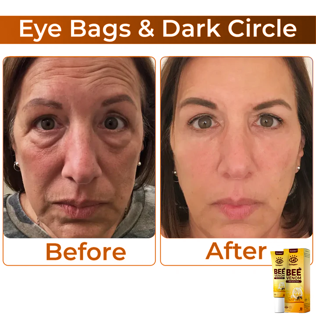 BeeVenom™ – Crème contour des yeux au venin d’abeille pour une jeunesse éclatante [1 + 1 Gratuit]