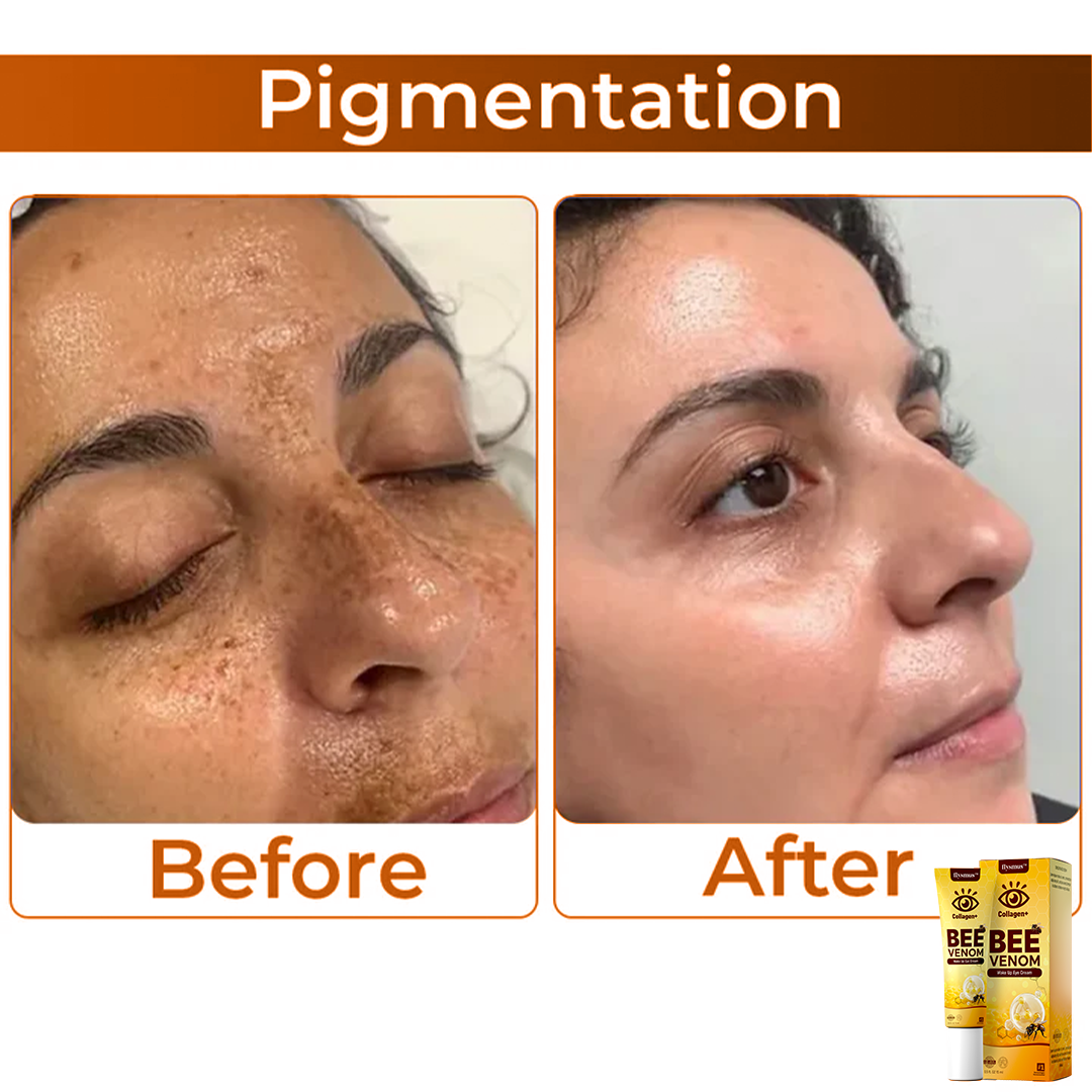 BeeVenom™ – Crème contour des yeux au venin d’abeille pour une jeunesse éclatante [1 + 1 Gratuit]