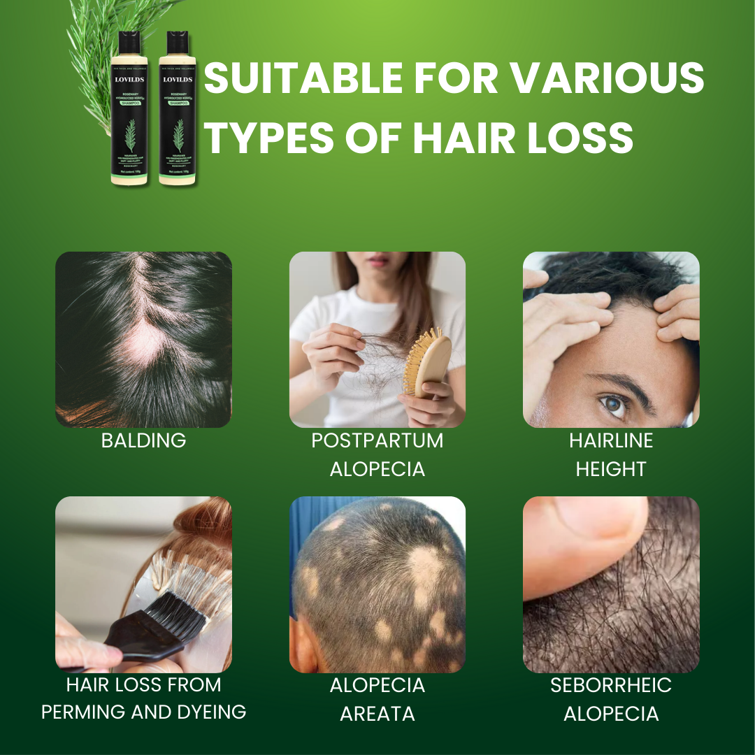 Sérum Capillaire Densifiant à la Kératine et au Romarin pour Cheveux Fins