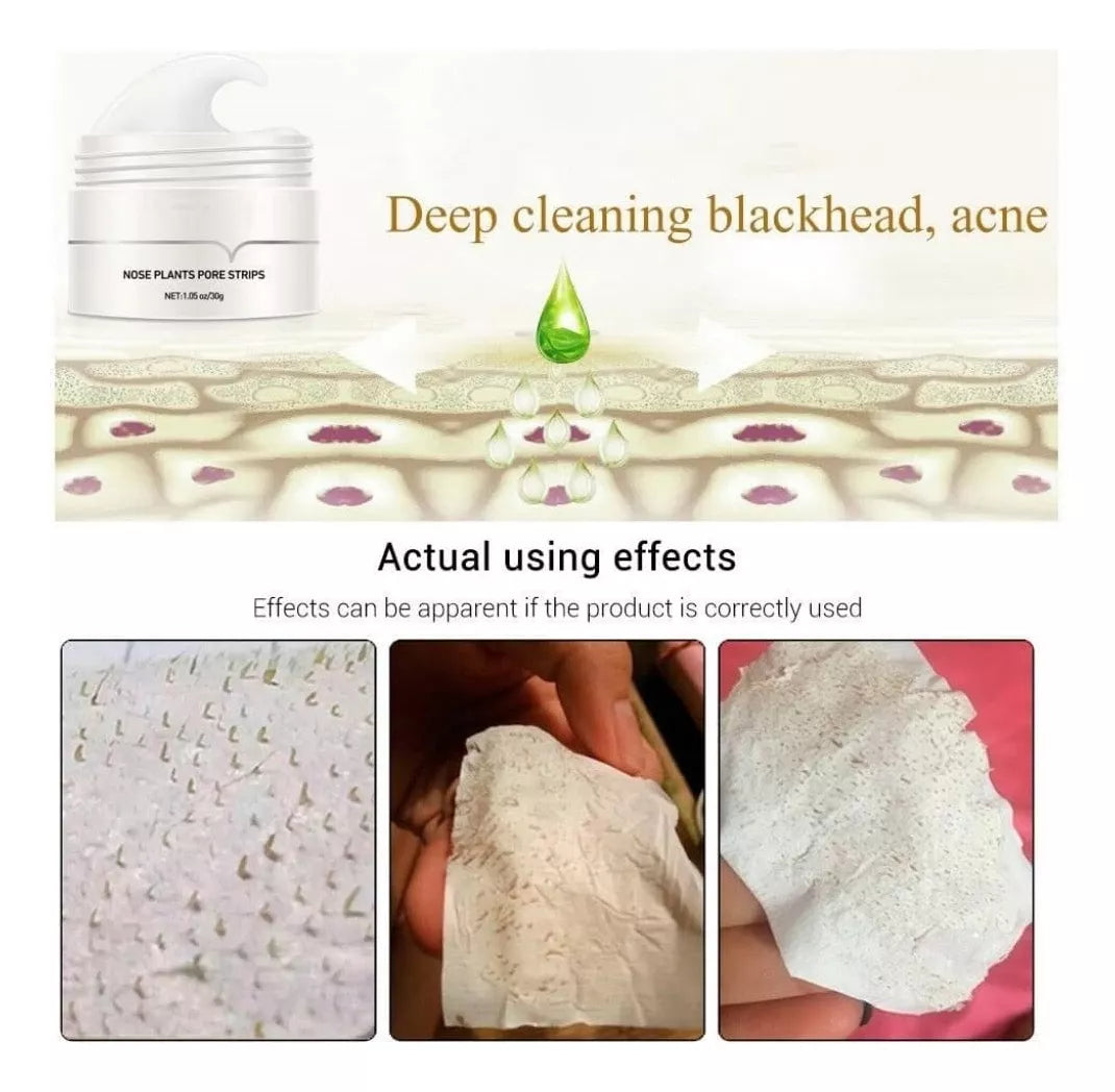 Patches Anti-Points Noirs au Charbon Actif pour Peau Purifiée