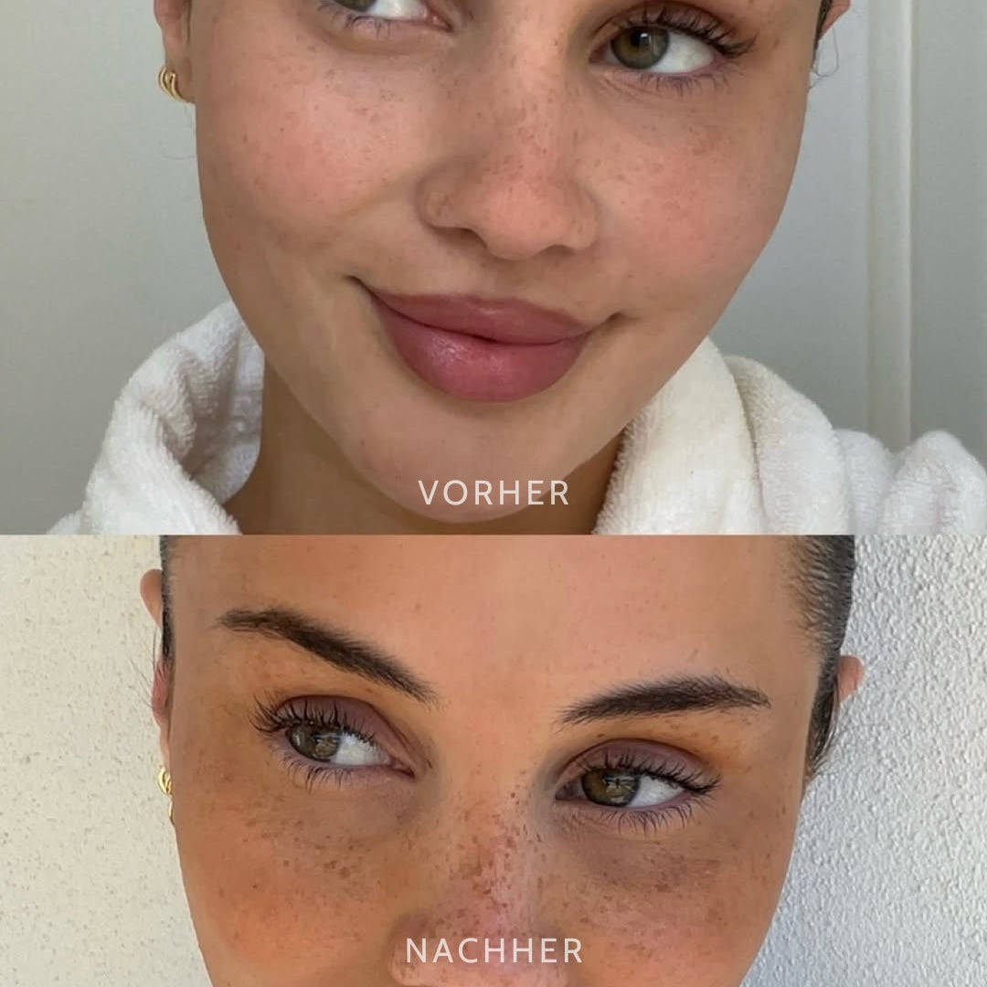 SpeckleTouch™ – Accent beauté ludique et accrocheur [50 % de réduction]