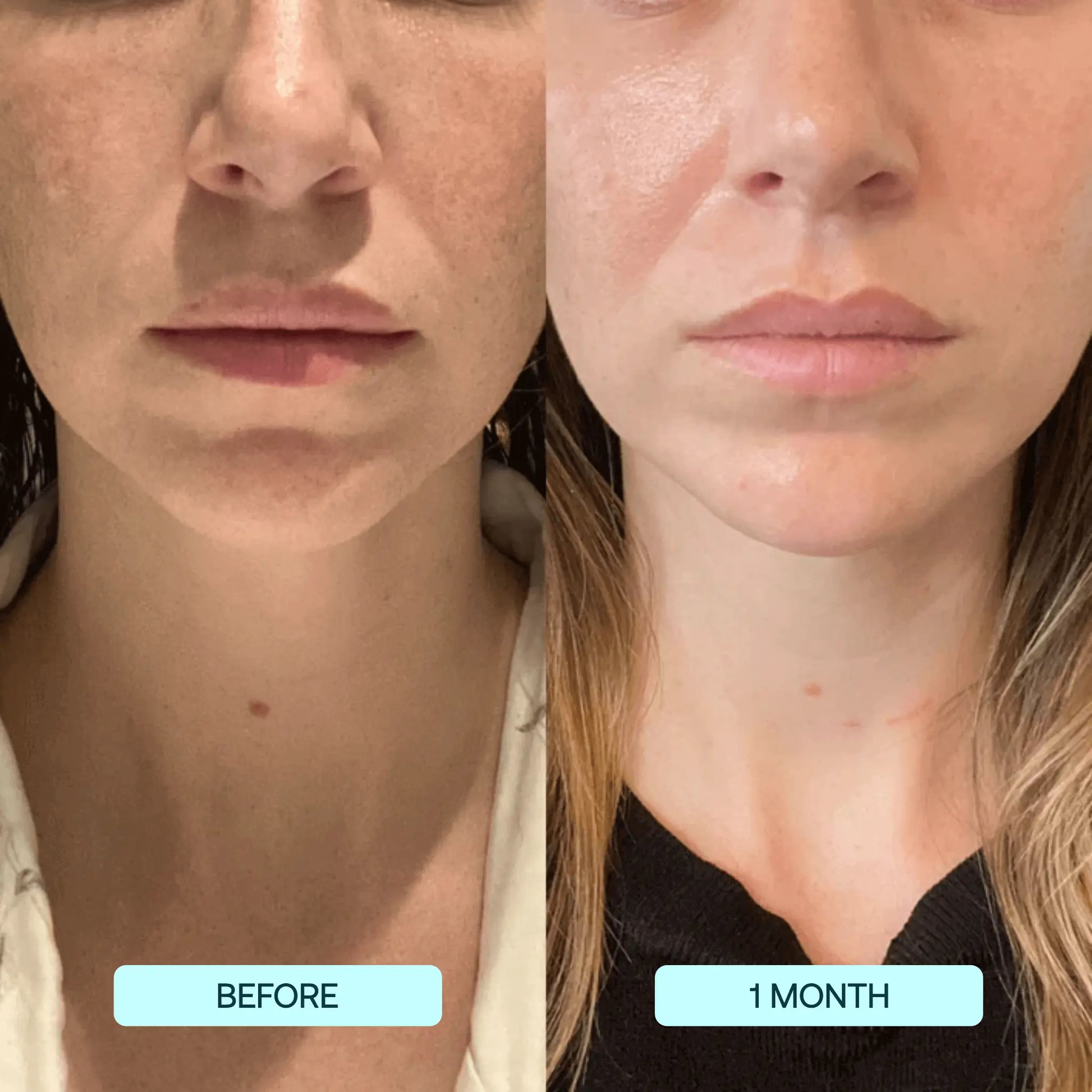 GlowSkin™ – Peau lisse instantanément [1 + 1 Gratuit]