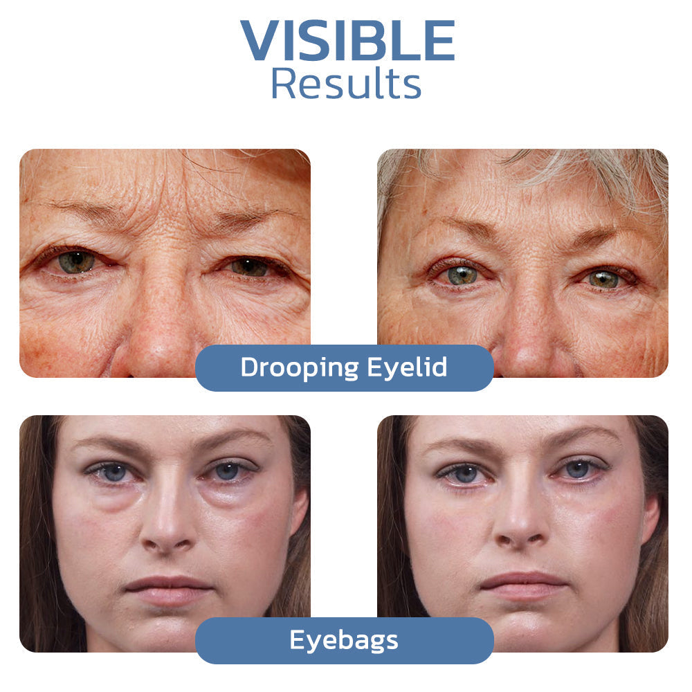 Gel Contour des Yeux aux Peptides – Raffermissant & Anti-Poches
