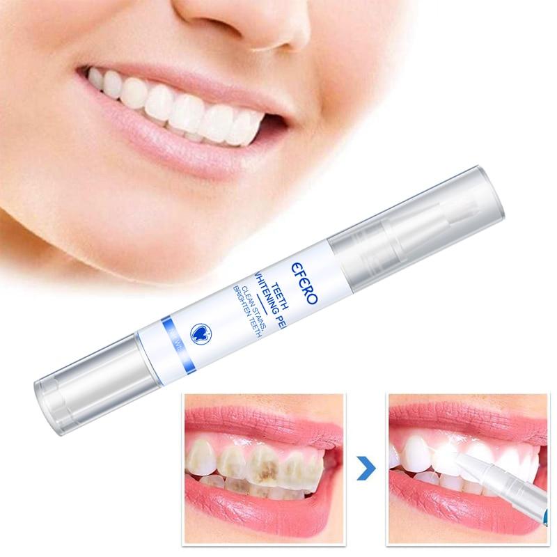 Stylo Blanchissant pour Dents – Blanchiment Doux & Efficace