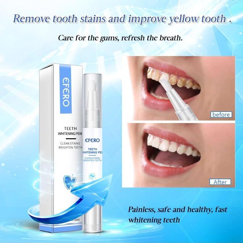 Stylo Blanchissant pour Dents – Blanchiment Doux & Efficace