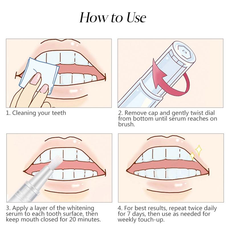 Stylo Blanchissant pour Dents – Blanchiment Doux & Efficace