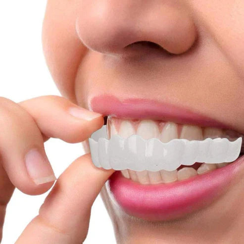 Facettes Dentaires Thermoformables pour un Sourire Blanc et Éclatant