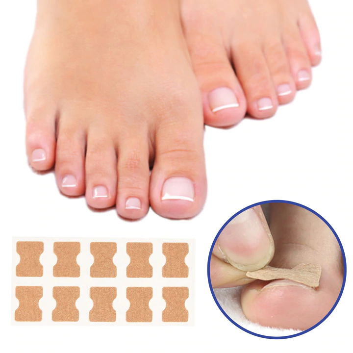 Correcteur d'Ongles Incarnés – Patchs de Redressement pour Pieds Soignés