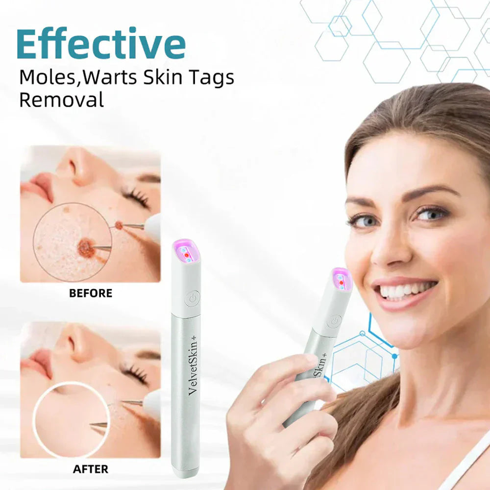 Stylo Laser CO₂ Micro-Focus pour Traitement des Imperfections Cutanées