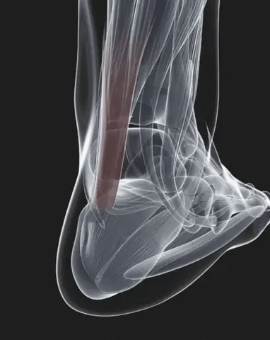 Attelle de Nuit pour Fascia Plantaire – Étirement Doux du Pied