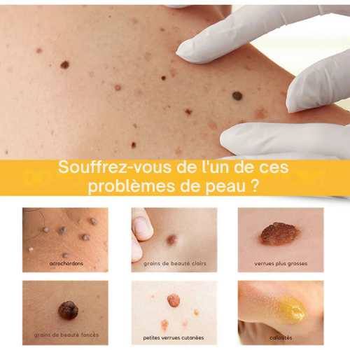 Sérum Soin Ciblé Excroissances Cutanées et Taches Pigmentaires