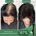 Sérum Bio pour Cheveux avec Roller – Soin Naturel pour Cheveux Plus Denses