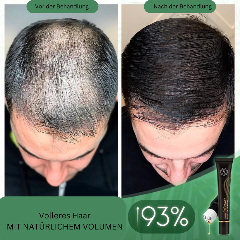 Sérum Bio pour Cheveux avec Roller – Soin Naturel pour Cheveux Plus Denses