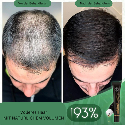 Sérum Bio pour Cheveux avec Roller – Soin Naturel pour Cheveux Plus Denses
