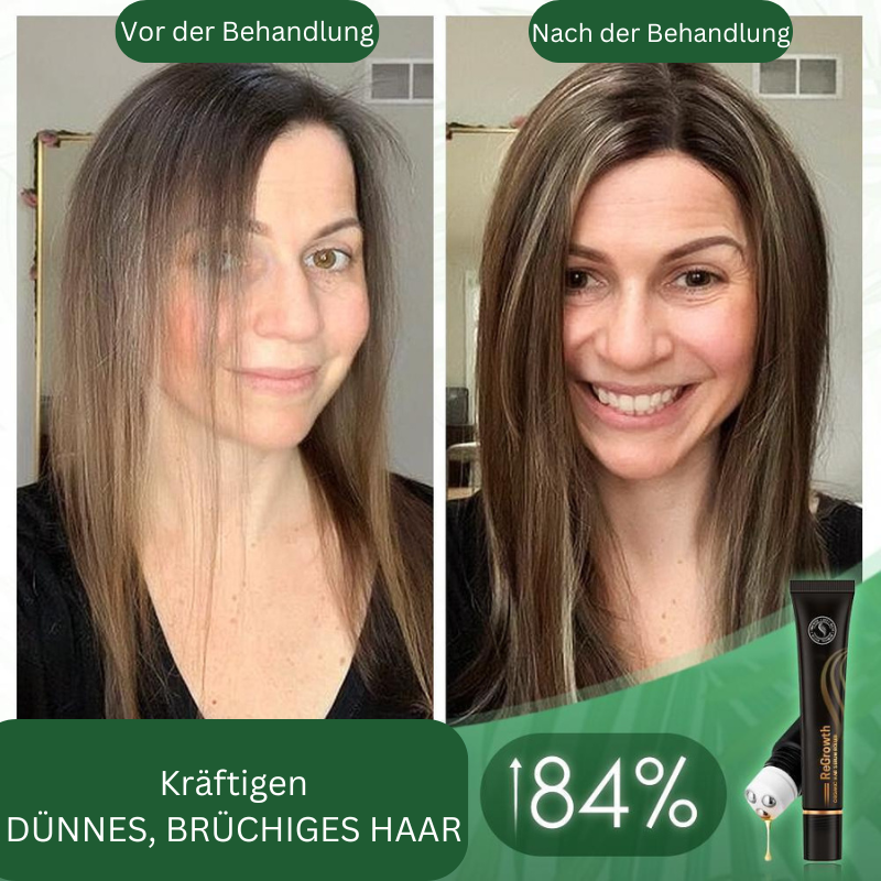 Sérum Bio pour Cheveux avec Roller – Soin Naturel pour Cheveux Plus Denses