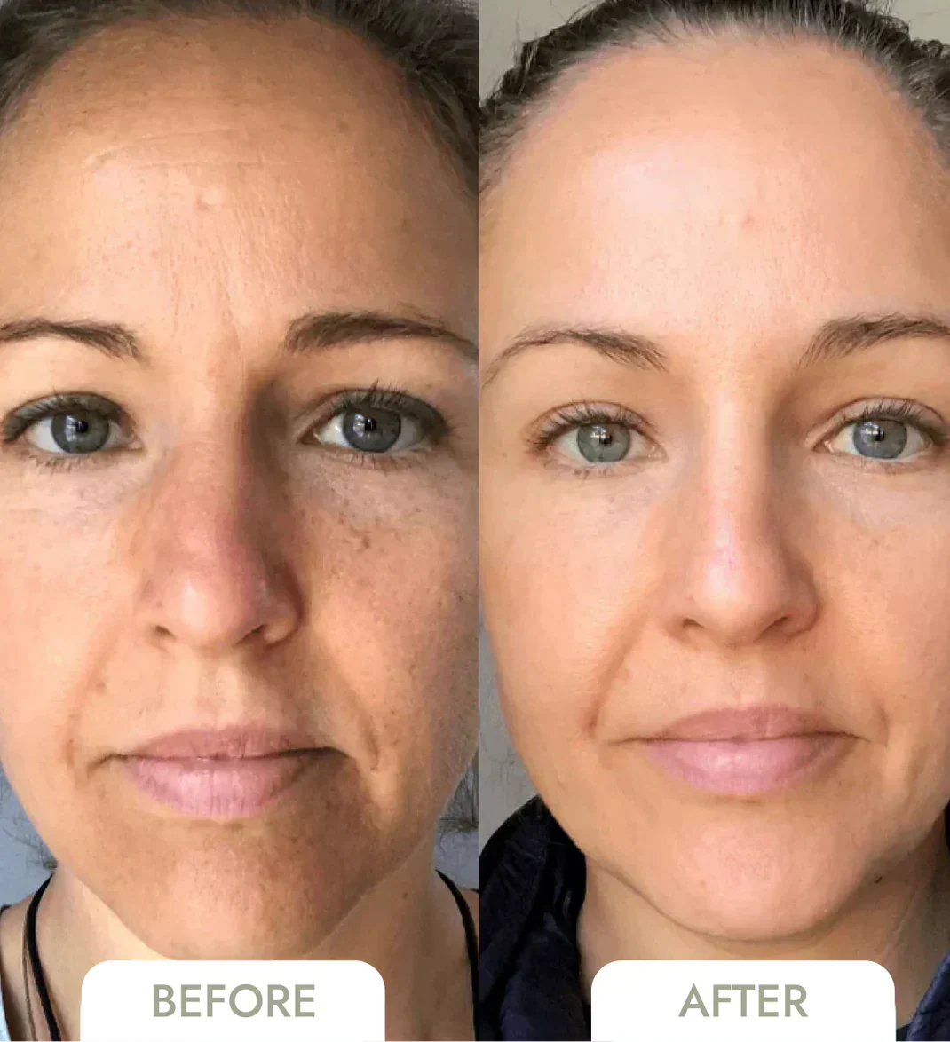 GlowSkin™ – Peau lisse instantanément [1 + 1 Gratuit]