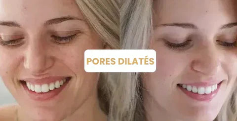 Mexena™ – Nettoyez toutes les impuretés en un seul geste ! [1 + 1 Gratuit]