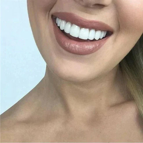 Facettes Dentaires Thermoformables pour un Sourire Blanc et Éclatant