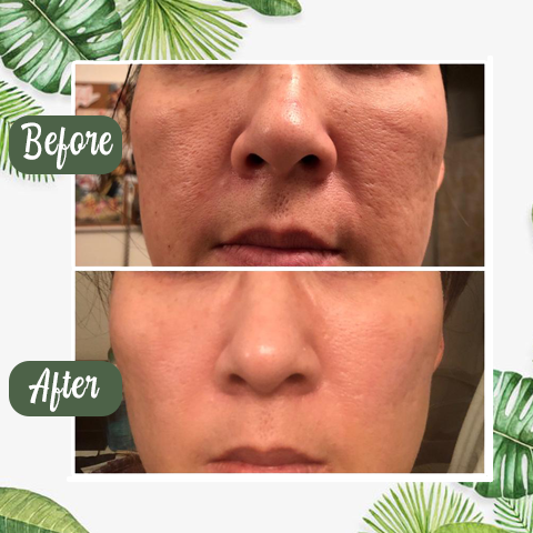 Stick Masque au Thé Vert Nettoyant en Profondeur pour Pores Purs