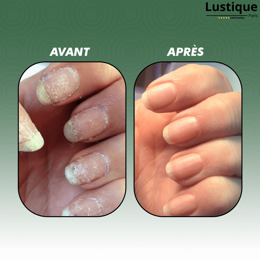 Soin Réparateur pour Ongles à Formule Végétale – 30 ml