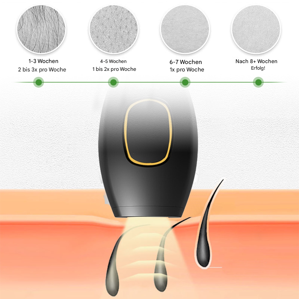 SilkGlow™ – Épilateur laser indolore pour une peau soyeuse [50 % de réduction]