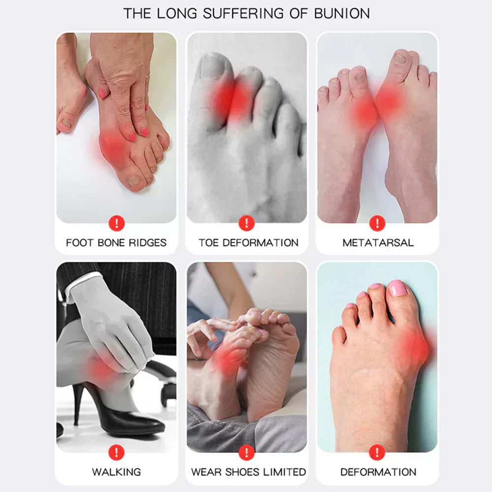HalluxValgus™ - Votre solution confortable pour des pieds sans douleur ! [1 + 1 Gratuit]