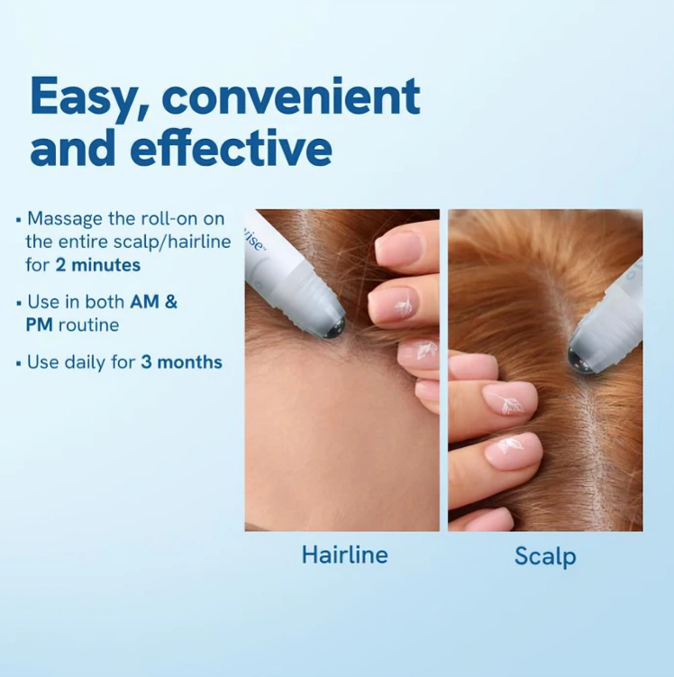 HairGrowth™ – Roller sérum pour la pousse des cheveux contre la chute, pour une chevelure fortifiée [1 + 1 Gratuit]