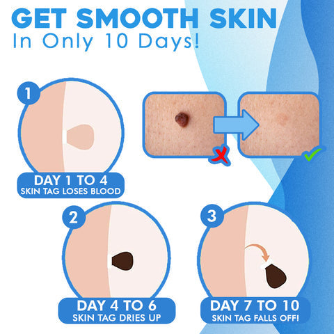 DermFree™ – Épilation indolore, douce et efficace [50 % de réduction]