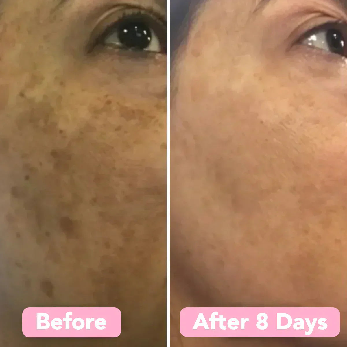 GlowPurify™ – Renouvellement Éclatant de la Peau & Nettoyage en Profondeur [50 % de Réduction]