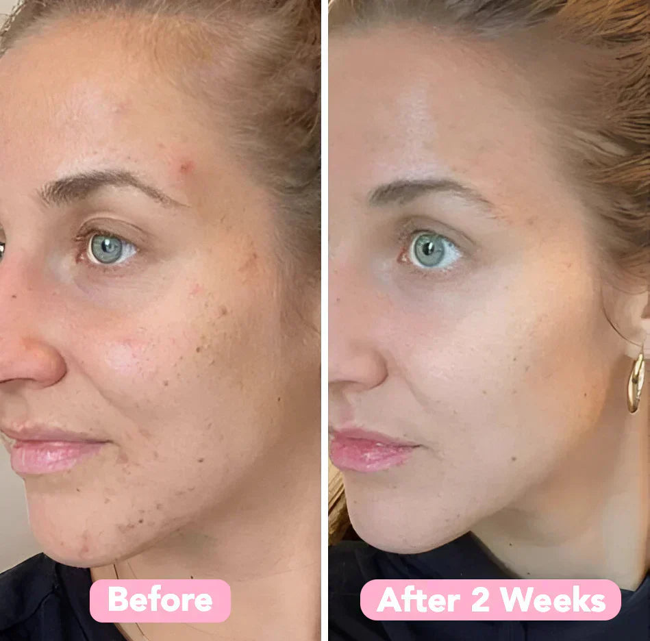 GlowPurify™ – Renouvellement Éclatant de la Peau & Nettoyage en Profondeur [50 % de Réduction]