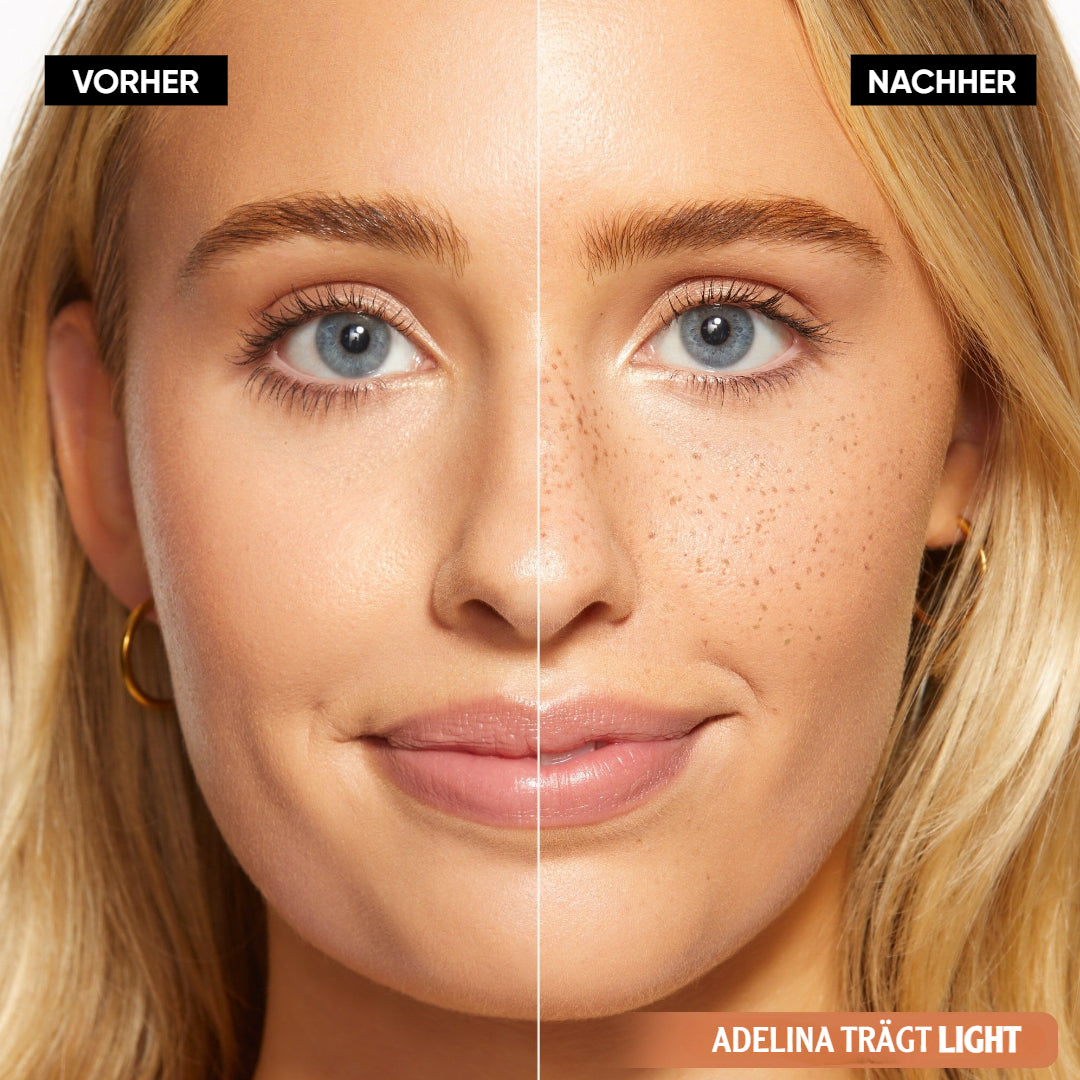 SpeckleTouch™ – Accent beauté ludique et accrocheur [50 % de réduction]